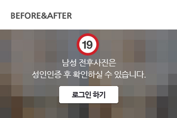 전후사진